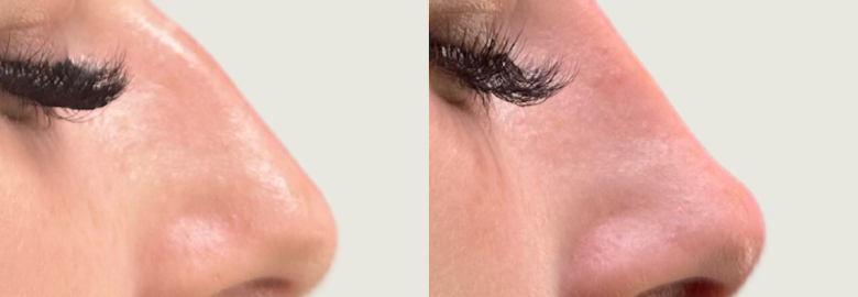 Allure Aesthetics