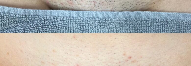 Lumen Laser Aesthetics